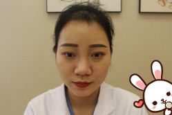 -大麦微针植发丨全国连锁