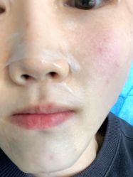 体验后-联合丽格·张菡丽格医疗美容