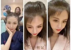 点击看大图 -熙朵美学植发连锁
