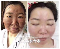 -兰派国际美容养生SPA