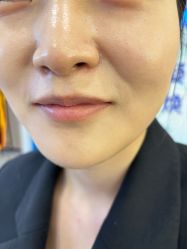 -长沙雅美医疗美容医院