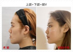 -上海时光整形外科医院