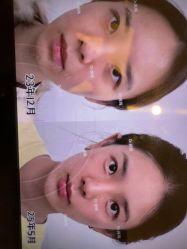点击看大图 -Yestar杭州艺星医疗美容医院