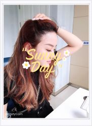 点击看大图 体验后-大麦微针植发全国连锁