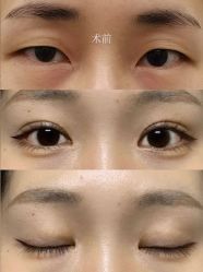 -上海漾颜医疗美容