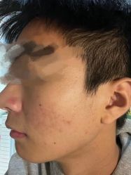 -元熙兰积皮肤管理
