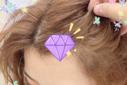 -大麦微针植发全国连锁