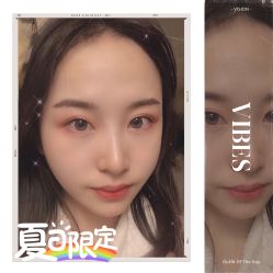 -大麦微针植发全国连锁