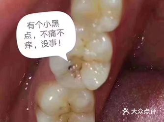 牙齿上的小黑点，刷不掉怎么办呢？