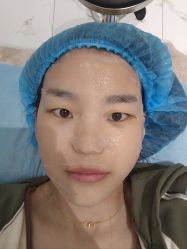 体验后-武汉颜范薇美医疗美容门诊部