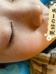 -成都大华医学美容医院