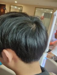 -碧莲盛·不剃发植发