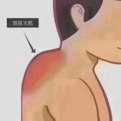 -香薇妮丝·定制减肥·身材管理
