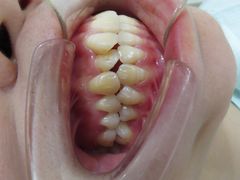 -宁波壹加壹口腔·矫正种植中心