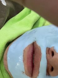 -苗医生0感祛痘连锁