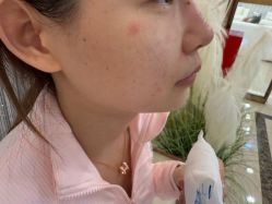 -长沙雅美医疗美容医院