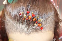 -大麦微针植发全国连锁