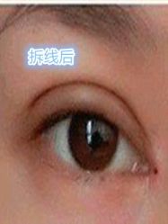 -美莱医学美容医院