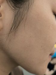 -美瑞莎创美医疗美容