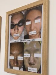 -美肤盾祛痘·问题肌头疗管理中心