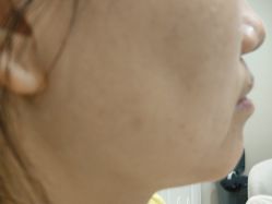 -长沙雅美医疗美容医院