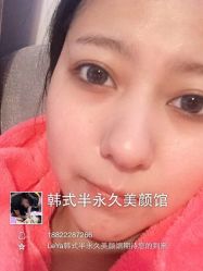 做之前-LEYA皮肤管理