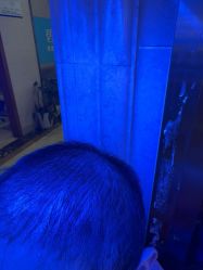 -碧莲盛·不剃发植发