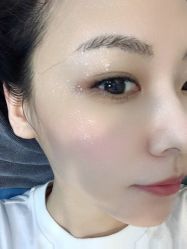-More摩尔医美の注射线雕光电中心