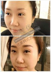 -YooMee优美智能科技美肤机构