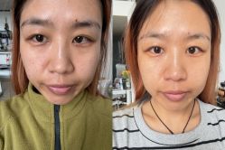 -上海伊莱美医疗美容医院
