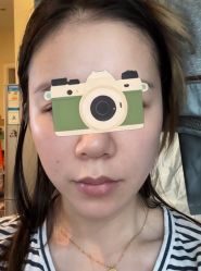 体验后-亿美医疗美容·半岛大超炮官方授权店