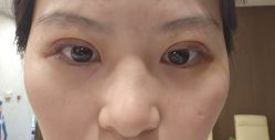 体验后-上海玫瑰医疗美容医院