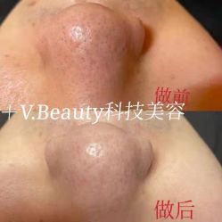 点击看大图 -苑苑vbeauty科技美容SPA