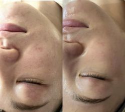 -杭州米兰柏羽医疗美容医院