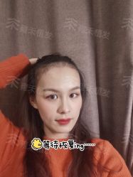 -雍禾植发全国连锁