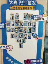 -大麦微针植发丨全国连锁