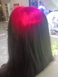-碧莲盛·不剃发植发