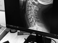 -龙脊康·颈肩腰腿痛·脊柱侧弯·运动损伤脊柱专科门诊(天河店)