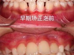 -精德口腔·种植修复·儿牙中心(财富中心店)