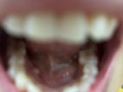 -极光口腔·矫正种植修复(锦江院区)