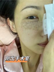 点击看大图 体验后-天津时光诺颜·轻医美·轮廓抗衰中心