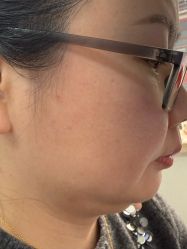 -长沙雅美医疗美容医院