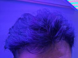 -熙朵美学植发·连锁品牌