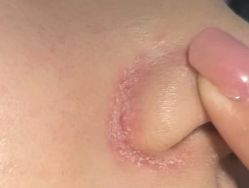 点击看大图 -MLP美丽派·问题肌疗愈中心