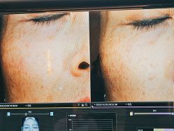 -苑苑vbeauty科技美容SPA