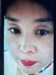 -西安壹加壹医疗美容·西北抗衰旗舰店