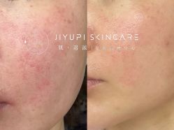 点击看大图 -MLP美丽派·问题肌疗愈中心