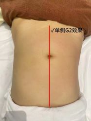 -Lily纤美·科技减脂中心