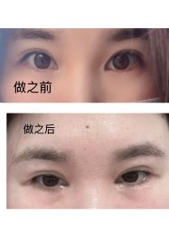 -杭州美莱医疗美容医院