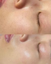 -美愈美肤MEIYU SKIN